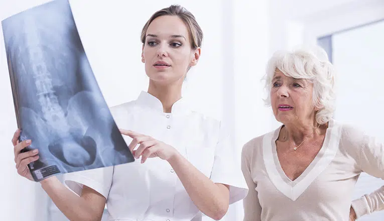 Een dokter laat een MRI-scan zien aan een vrouw met klachten van artrose in de rug.