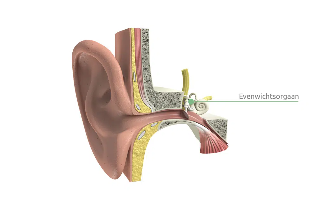 De duizeligheid oorzaken: een verstoord evenwichtsorgaan. Dit orgaan zit in het oor.